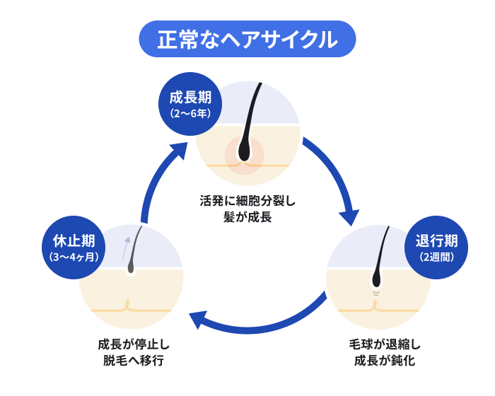 「ヘアサイクル」の仕組みを図解。数年の期間をかけて毛球が太く長く成長する「成長期」、毛球が退縮し始める約2週間の「退行期」、毛球が完全に退化した約3〜4ヶ月の「休止期」を経て脱毛し、再び新しい毛が生え始めるまでの一連の流れを解説。