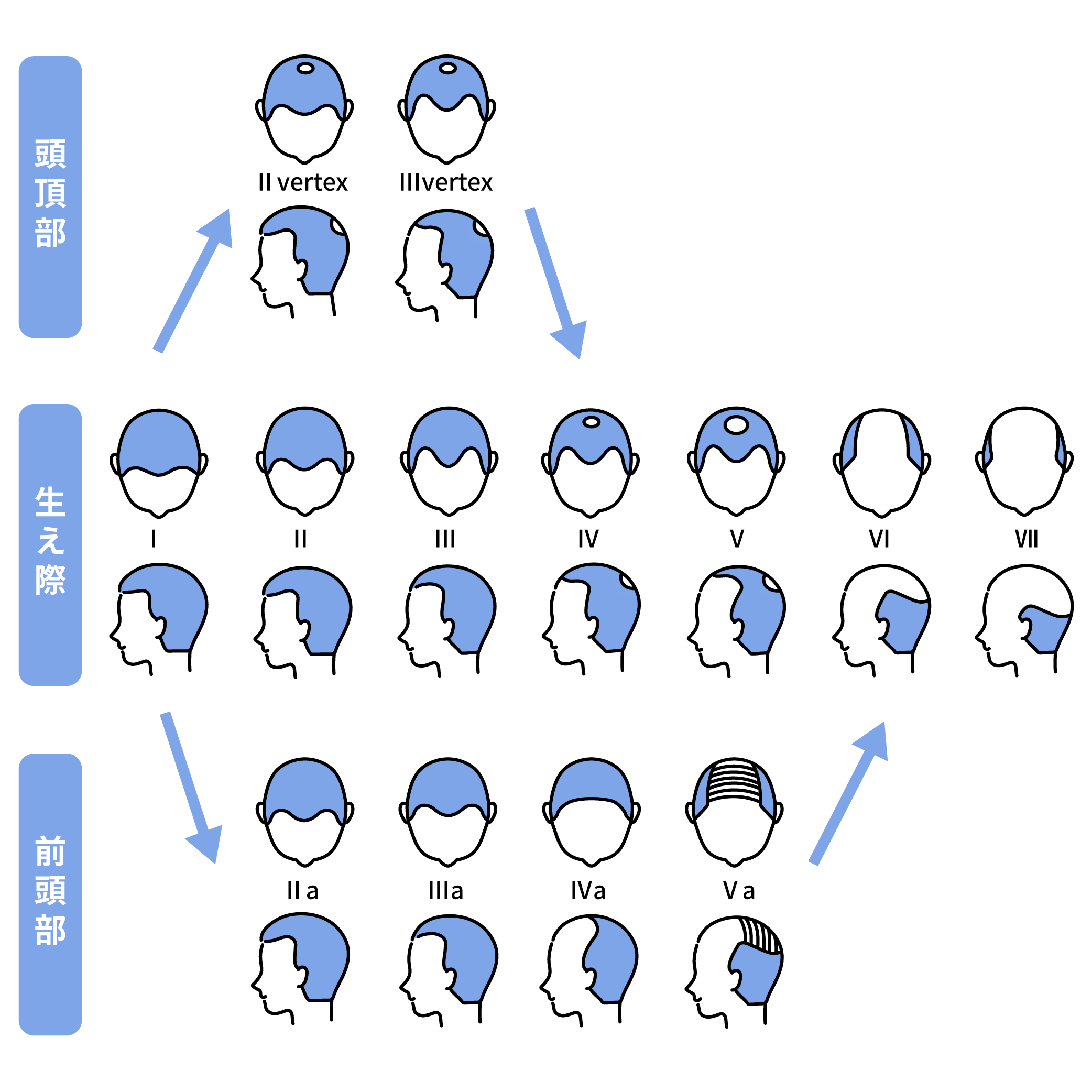 頭頂部・生え際・前頭部のイラストイメージ