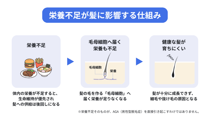 栄養不足が髪に影響する仕組みを示したイラスト(栄養不足になると毛母細胞へ届く栄養が不足し、健康な髪が育ちにくい)
