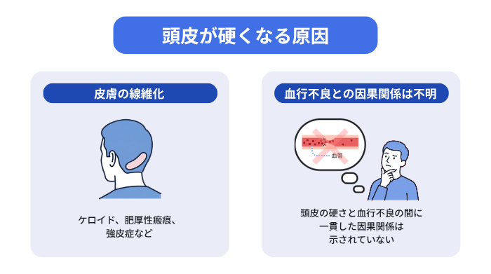 頭皮が硬くなる原因は皮膚の線維化で、血行不良との因果関係は不明であることを示すイラスト