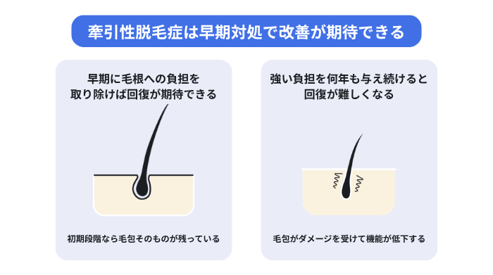 牽引性脱毛症は早期対処で改善が期待できる(早期に毛根への負担を取り除けば回復が期待できる。強い負担を何年も与え続けると回復が難しくなる)