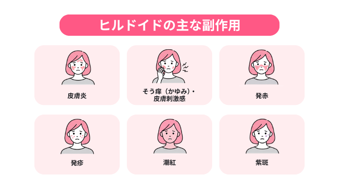 ヒルドイドの報告されている副作用(皮膚炎・そう痒(かゆみ)・発赤・発疹・潮紅・紫斑)を解説。各症状の特徴が分かるよう、副作用を発症している女性の顔イラストを並べている図。