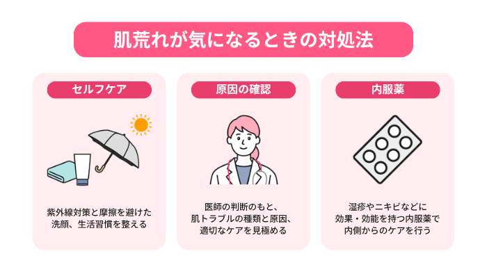 肌荒れが気になるときの対処法を3項目に分けて説明する図。紫外線対策・刺激の少ない洗顔・生活習慣の見直しを推奨する「セルフケア」、医師への相談を通して肌ケアを見極める「原因の確認」、湿疹やニキビなどへの承認効能がある「内服薬」をイラスト付きで解説。