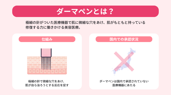 極細の針がついた医療機器のダーマペンが肌に微細な穴をあけ、自然な修復力を促す仕組みと、国内で未承認の医療機器にあたることを示す図。