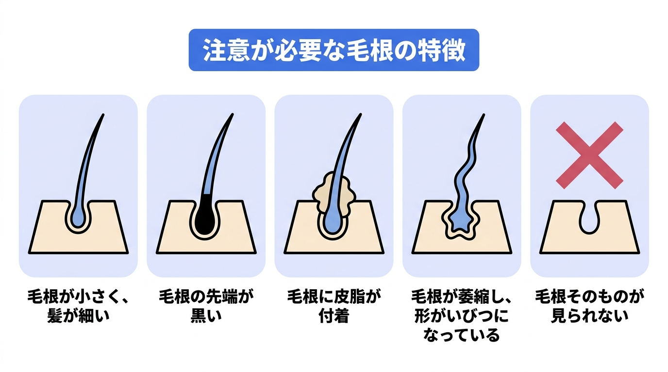 注意が必要な毛根の特徴(毛根が小さく髪が細い、毛根の先端が黒い、毛根に皮脂が付着、毛根が萎縮し形がいびつになっている、毛根そのものが見られない)