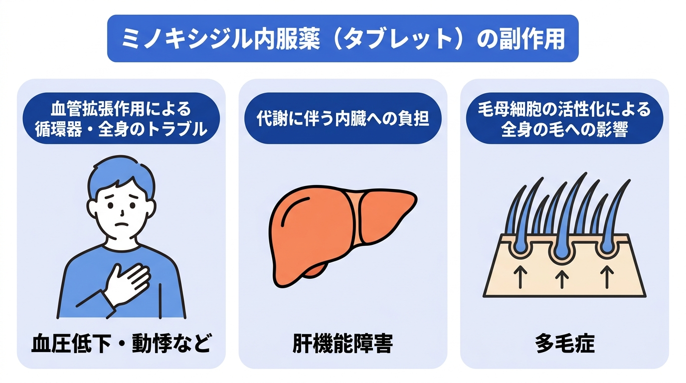 ミノキシジル内服薬(タブレット)の副作用を解説。血管拡張作用による循環器や全身のトラブルとして血圧低下や動悸など、代謝に伴う内臓への負担として肝機能障害、毛母細胞の活性化による多毛症などが考えられる。