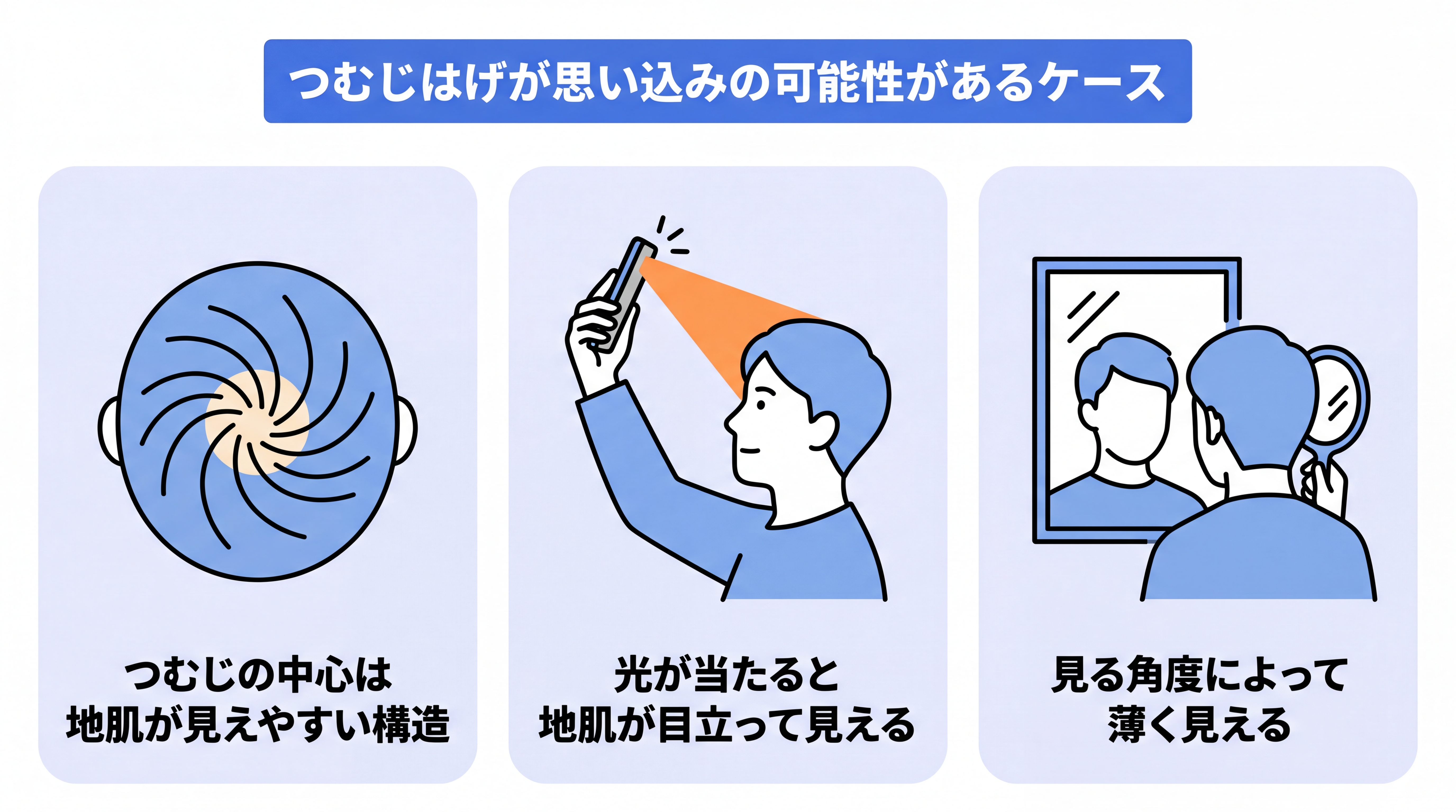 つむじはげがAGAなどによる薄毛の進行ではない3つのケースを示すイラスト。つむじの中心は渦を巻いているので地肌が見えやすい。スマホのフラッシュ撮影などで光が当たると地肌が目立つことがある。合わせ鏡など、様々な角度からつむじを見ると薄く見えることがある。