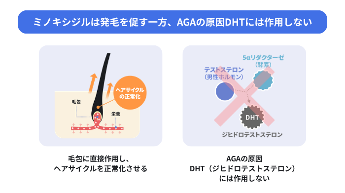ミノキシジルの効果を示した図。左側は毛包に直接作用してヘアサイクルを正常化させ発毛を促進する仕組み、右側はAGAの原因物質DHTの生成抑制には作用しないことを説明している。