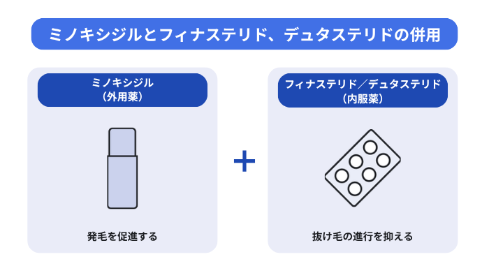 ミノキシジルとフィナステリド、デュタステリドの併用を示した図。発毛を促進する外用薬のミノキシジルと、抜け毛の進行を抑える内服薬のフィナステリドまたはデュタステリドを組み合わせる効果を図解している。