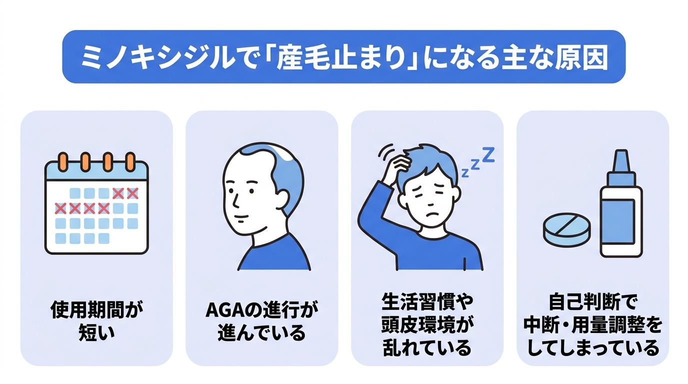 ミノキシジルの使用で産毛止まりになる主な原因として、使用期間の短さ、AGAの進行、生活習慣や頭皮環境の乱れ、自己判断による中断や用量調整の4つを示した図。