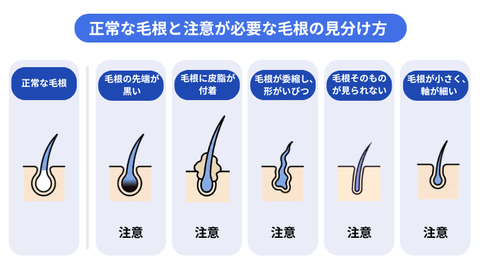 正常な毛根と注意が必要な毛根の状態の違いを比較したイラスト。注意が必要な毛根:先端が黒い、皮脂が付着している、萎縮して形がいびつ、毛根がない、軸が小さく細い。