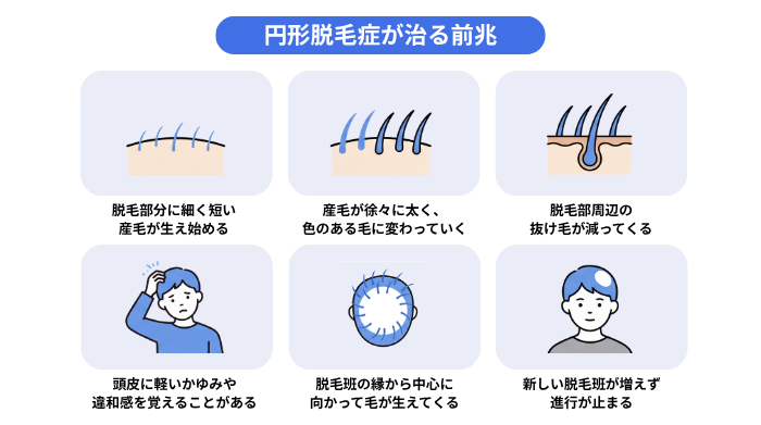 円形脱毛症が治る6つの前兆を表したイメージ図。脱毛部分に細く短い産毛が生え始める。産毛が徐々に太く、色のある毛に変わっていく。脱毛部周辺の抜け毛が減ってくる。頭皮に軽いかゆみや違和感を覚えることがある。脱毛斑の縁から中心に向かって毛が生えてくる。新しい脱毛斑が増えず進行が止まる。