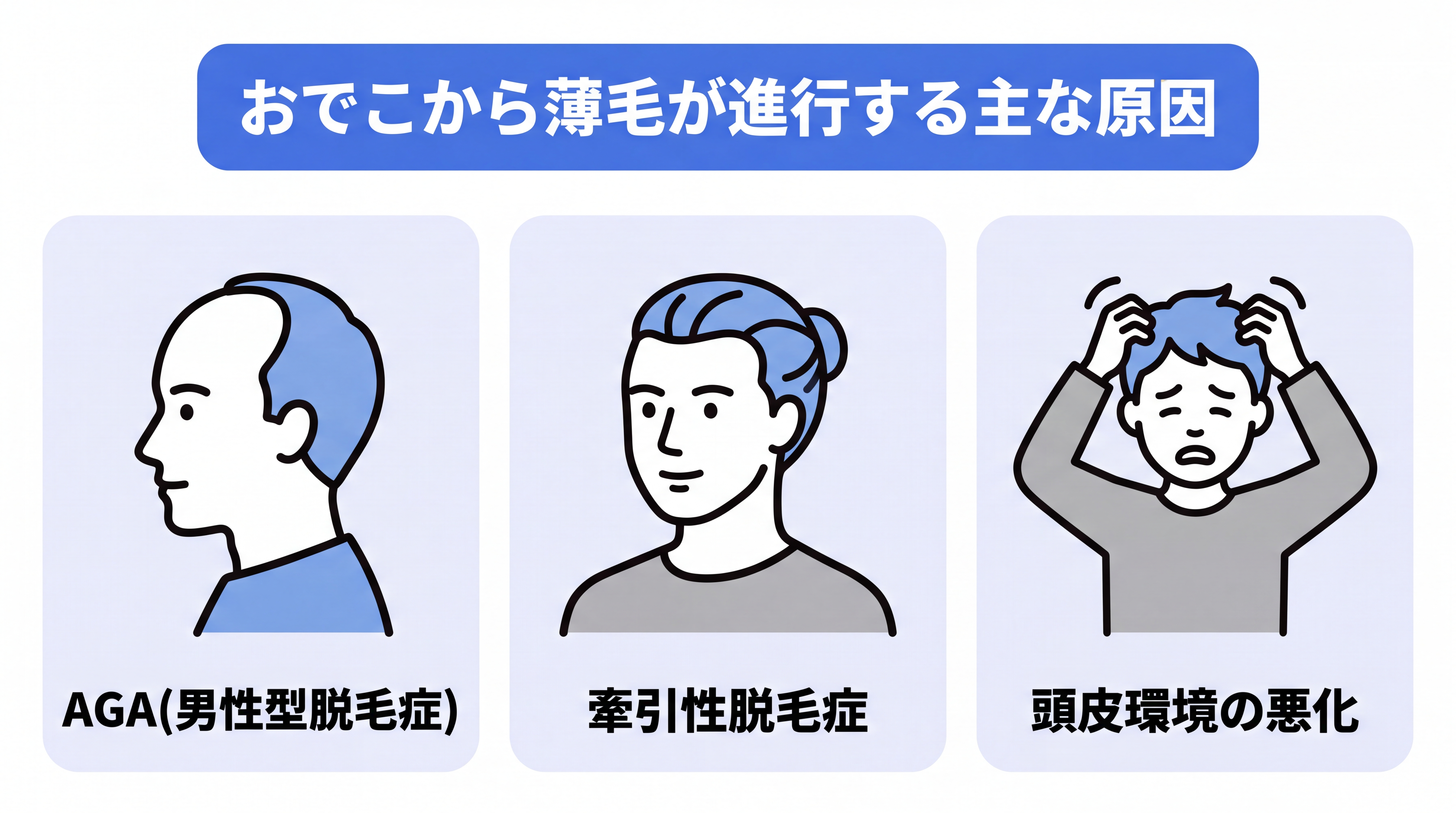 おでこから薄毛が進行する主な原因(AGA、牽引性脱毛症、頭皮環境の悪化)
