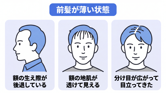 前髪が薄い状態(額の生え際が後退している、額の地肌が透けて見える、分け目が広がって目立ってきた)