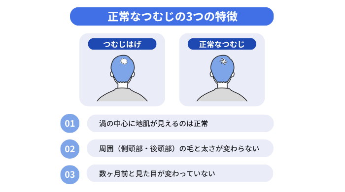 正常なつむじの3つの特徴(渦の中心に地肌が見える、側頭部や後頭部の毛と太さが変わらない、数ヶ月前と見た目が変わらない)