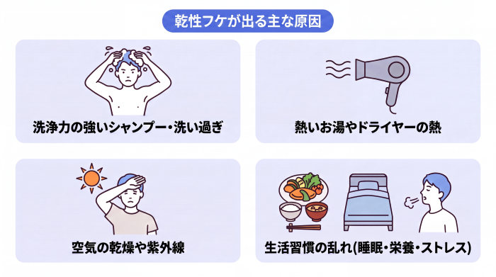 乾性フケが出る主な原因として、「洗浄力の強いシャンプーでの洗い過ぎ」「熱いお湯やドライヤーの熱」「空気の乾燥や紫外線」「睡眠・栄養・ストレスといった生活習慣の乱れ」の4つをイラストで説明。