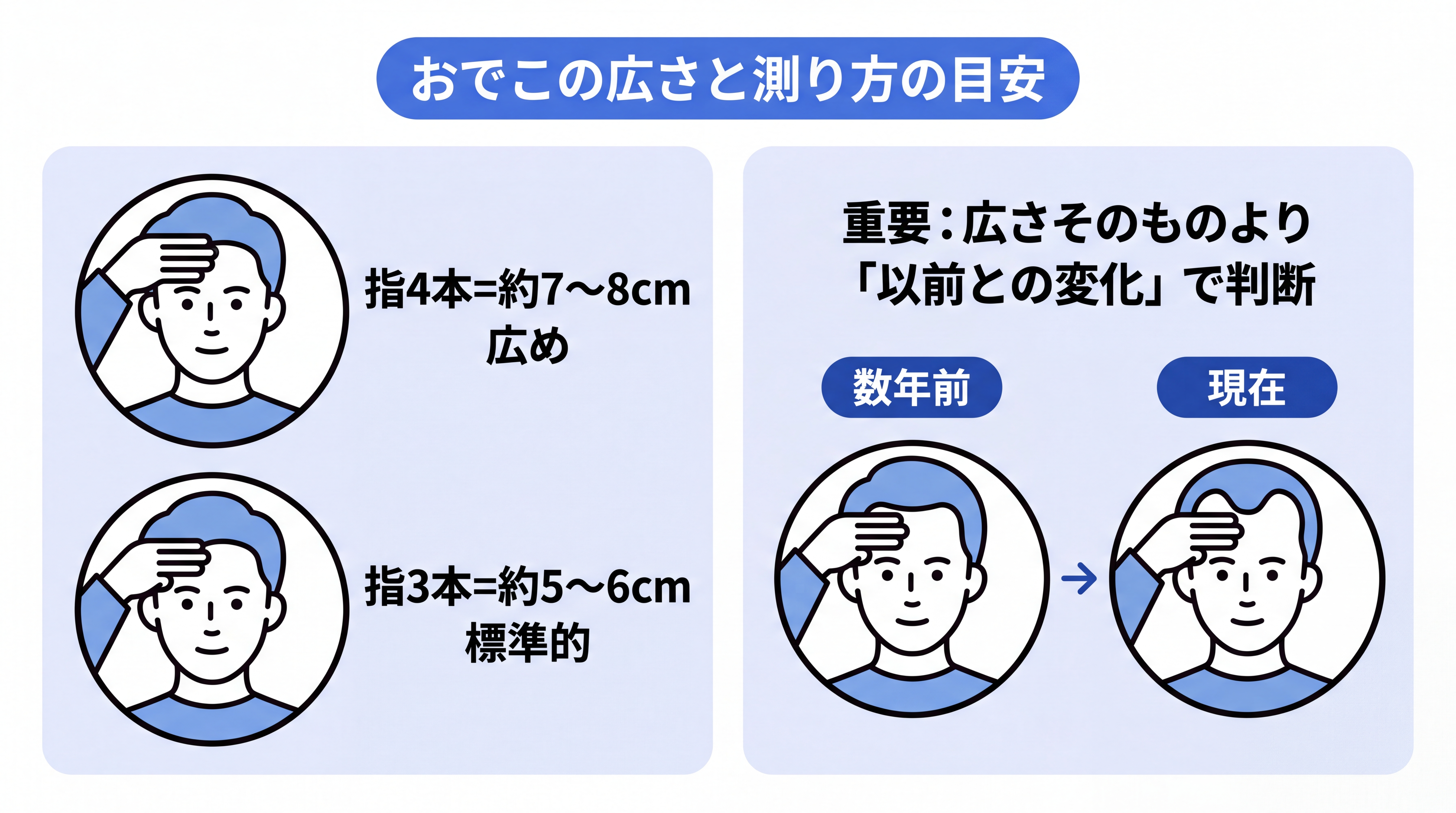 おでこの広さの測り方と目安(指3本=約5〜6cm/指4本=約7〜8cm)。広さそのものより「以前と比べた変化」で判断することを示す