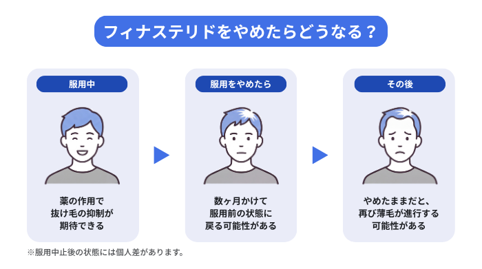 フィナステリドをやめた場合に考えられる状態のイメージ図。服用中は、薬の作用で抜け毛の抑制が期待できる。服用をやめたら、数ヶ月にかけて服用前の状態に戻る可能性がある。その後、服用をやめたままだと再び薄毛が進行する可能性がある。服用中止後の状態には個人差がある。