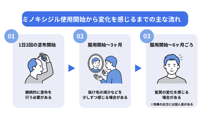 ミノキシジル外用薬の使用開始から変化を実感するまでの目安となる時系列フロー図。1日2回の継続塗布を開始後、3ヶ月頃に抜け毛の減少、6ヶ月頃に髪質の変化を感じる場合があり、継続的なケアが必要であることを示している。